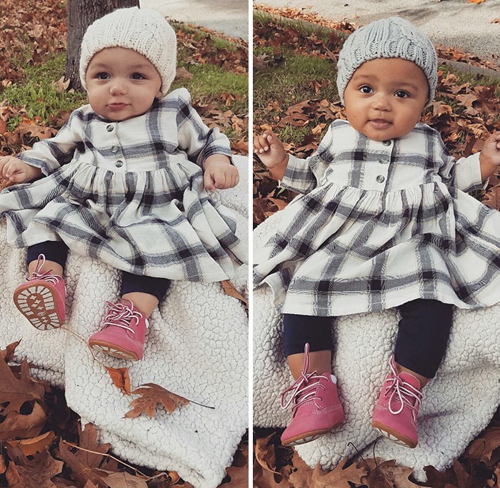 Amazing! These Twin Baby Girls Have Different Skin Colors - MojiDelano.Com